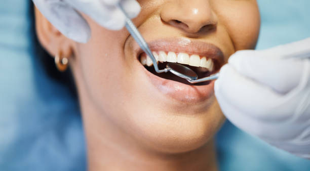 Best Emergency Dentist for Knocked-Out Tooth in Mattituck, NY